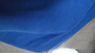 Nasty void urine in the bowl