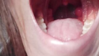 I accidently eat my ally [Trailer] [Dm to buy the full Ver.]