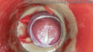 The camera inside the unfathomable snatch records a biggest spunk fountain with a stuck jo-bag