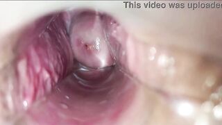 inside vaginal