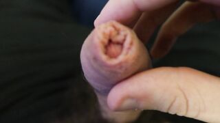 Playing with Foreskin (1080p HD)