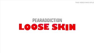 Loose Skin Full Episode