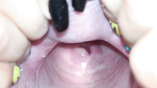 Cervix close up [4k]