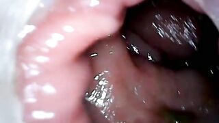 Anal endoscope part 1