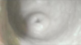 Befruchtung der Stute - Lehrvideo