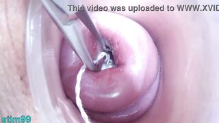 Lesbian babes pissing into the cervix of the other one directly since her pee gap